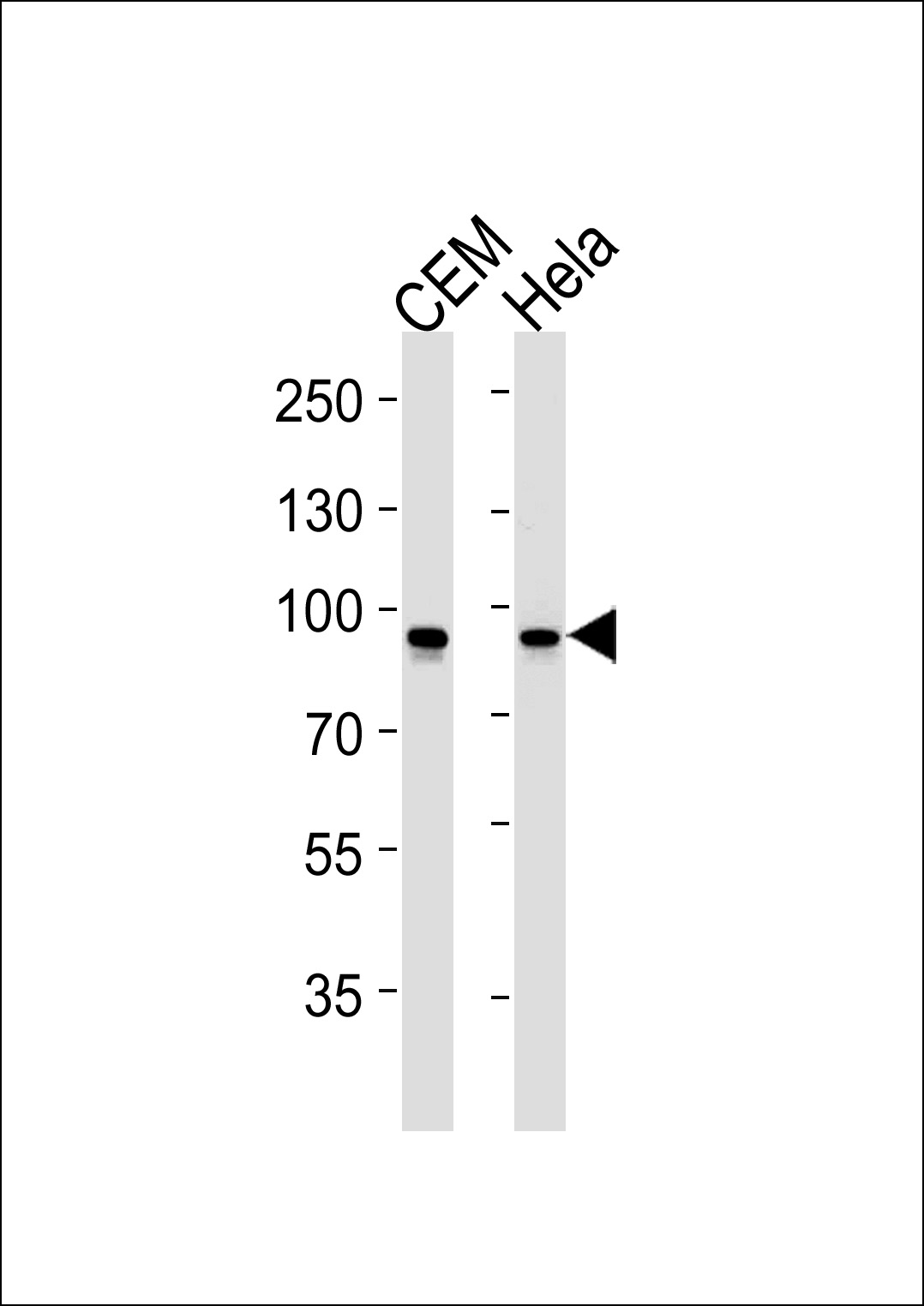 STAT1 Antibody(Cat. #AM2229b) western blot analysis in CEM,Hela cell line lysates (35?g/lane).This demonstrates the STAT1 antibody detected the STAT1 protein (arrow).