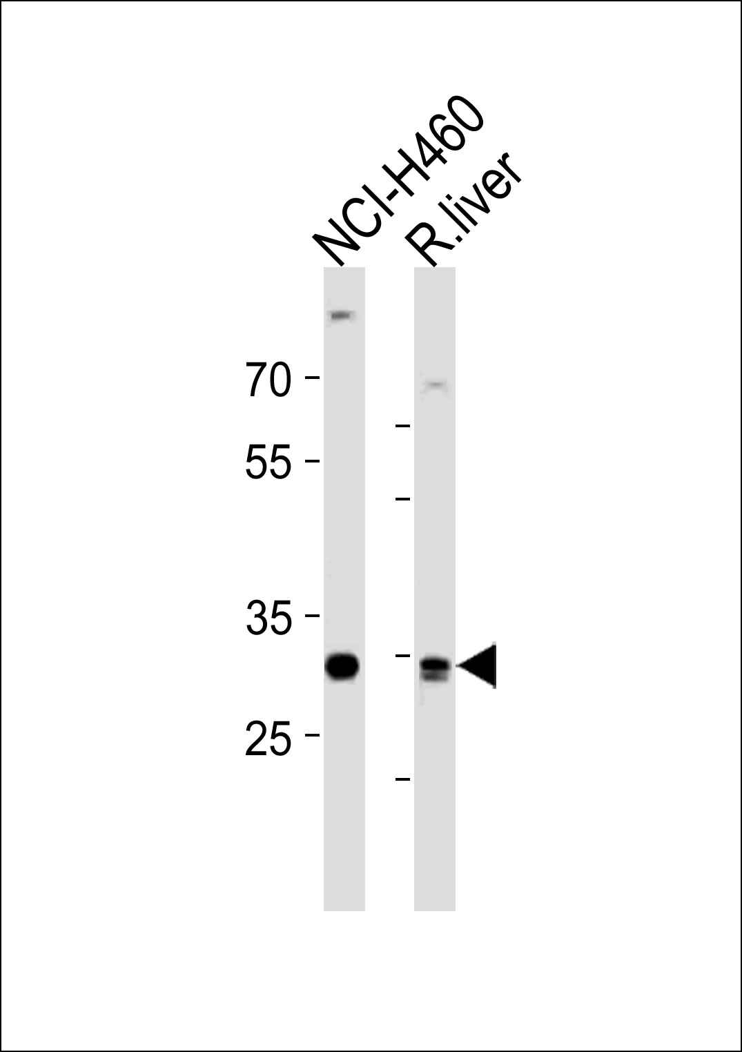 CALB1 Antibody (Center) (Cat. #AP20497c) western blot analysis in NCI-H460 cell line and rat liver tissue lysates (35ug/lane).This demonstrates the CALB1 antibody detected the CALB1 protein (arrow).