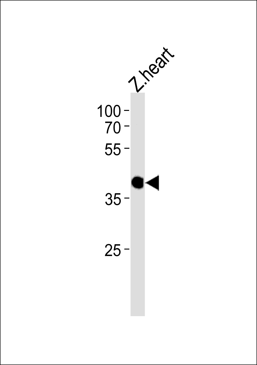 DANRE ccdc89 Antibody (C-term) (Cat. #Azb10026b) western blot analysis in zebra fish heart tissue lysates (35ug/lane).This demonstrates the DANRE ccdc89 antibody detected the DANRE ccdc89 protein (arrow).