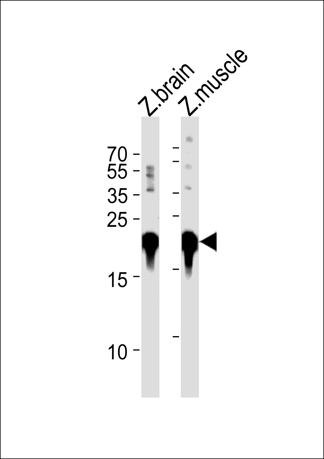 DANRE park7 Antibody (C-term) (Cat. #Azb10028b) western blot analysis in zebra fish brain and muscle tissue lysates (35ug/lane).This demonstrates the DANRE park7 antibody detected the DANRE park7 protein (arrow).