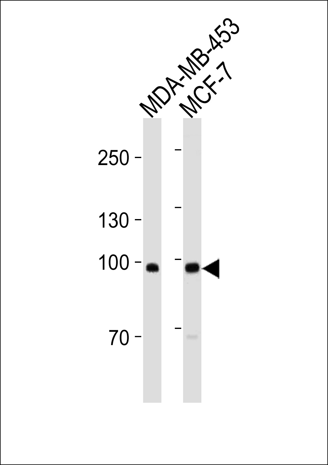 ACE2 (SARS Receptor) Antibody (Center) (Cat. #AM2197a) western blot analysis in MDA-MB-453,MCF-7 cell line lysates (35?g/lane).This demonstrates the ACE2 (SARS Receptor) antibody detected the ACE2 (SARS Receptor) protein (arrow).