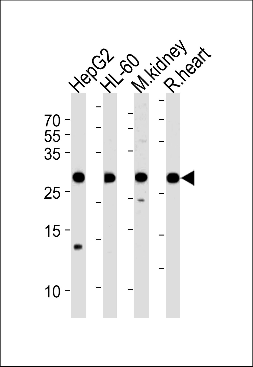 ATP5F1 Antibody (Center) (Cat. #AP20527c) western blot analysis in HepG2,HL-60 cell line,mouse kidney and rat heart tissue lysates (35ug/lane).This demonstrates the ATP5F1 antibody detected the ATP5F1 protein (arrow).