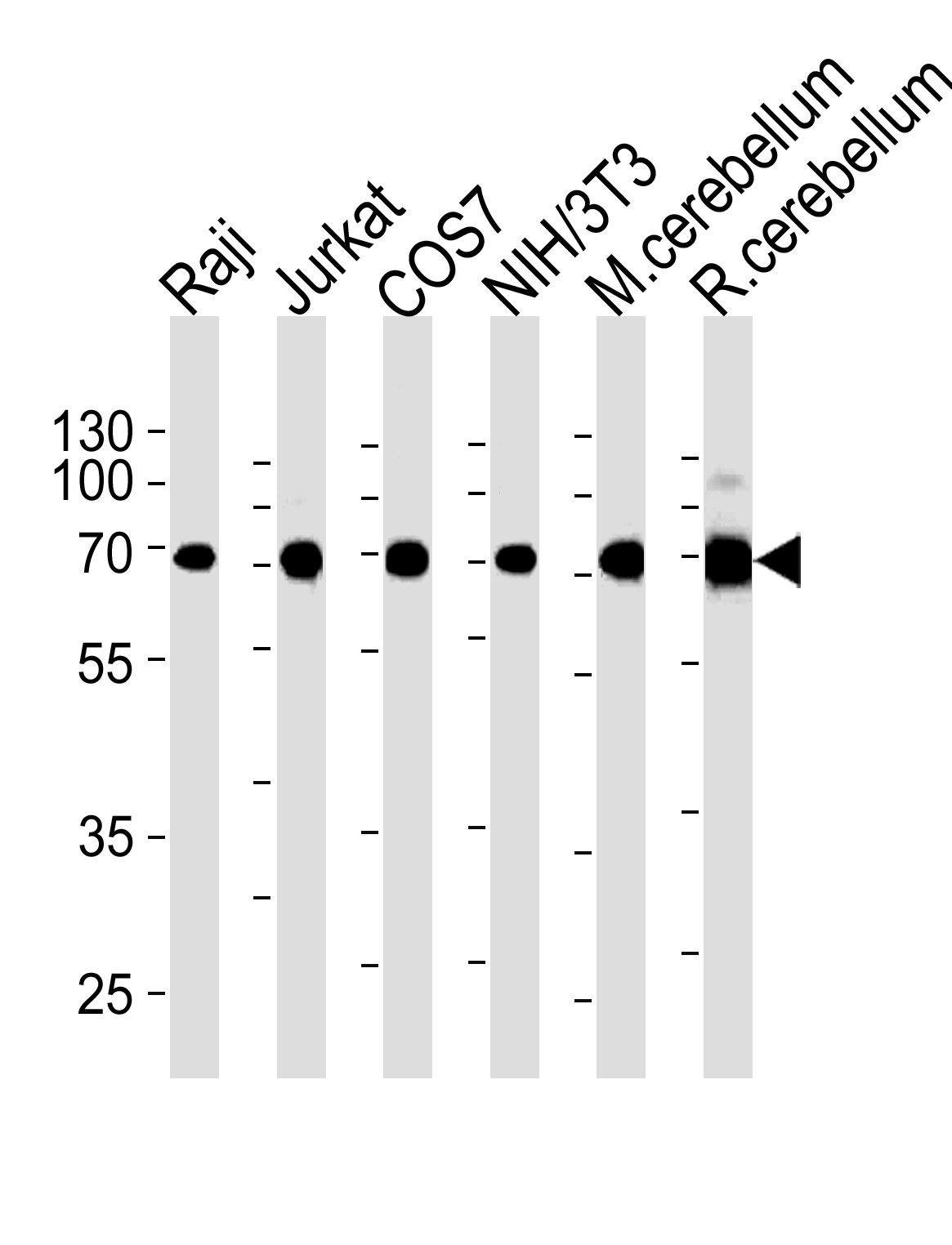 ACHE Antibody (C-term) (Cat. #AM2184b) western blot analysis in Raji,Jurkat,COS7,mouse NIH/3T3 cell line and mouse cerebellum,rat cerebellum tissue lysates (35?g/lane).This demonstrates the ACHE antibody detected the ACHE protein (arrow).