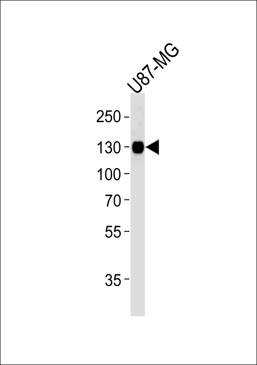 ITGB1 Antibody (Cat. #AM2241b) western blot analysis in U87-MG cell line lysates (35?g/lane).This demonstrates the ITGB1 antibody detected the ITGB1 protein (arrow).