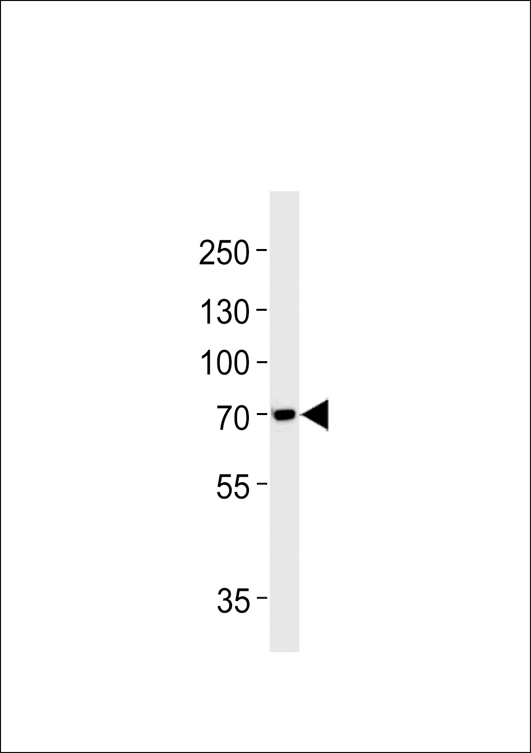 MAPT Antibody (pS720) (Cat.# AP1425c) western blot analysis in SH-SY5Y cell line lysates (35ug/lane).This demonstrates the MAPT antibody detected the MAPT protein (arrow).