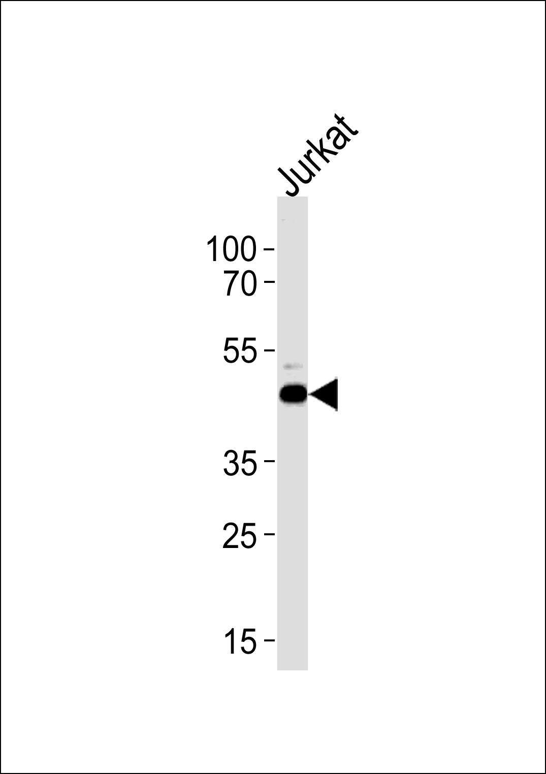 ATG4B Antibody (Center) (Cat. #AP20544c) western blot analysis in Jurkat cell line lysates (35ug/lane).This demonstrates the ATG4B antibody detected the ATG4B protein (arrow).