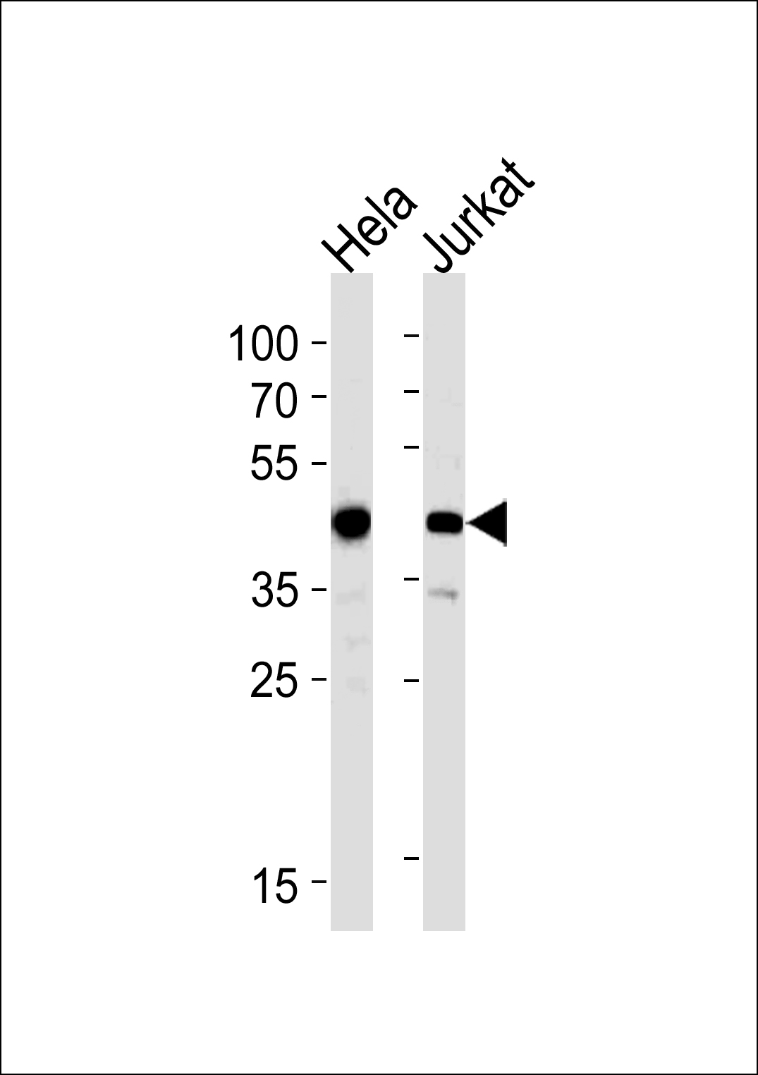 ACTR2 Antibody (Center) (Cat.# AP6533c) western blot analysis in Hela,Jurkat cell line lysates (35ug/lane).This demonstrates the ACTR2 antibody detected the ACTR2 protein (arrow).