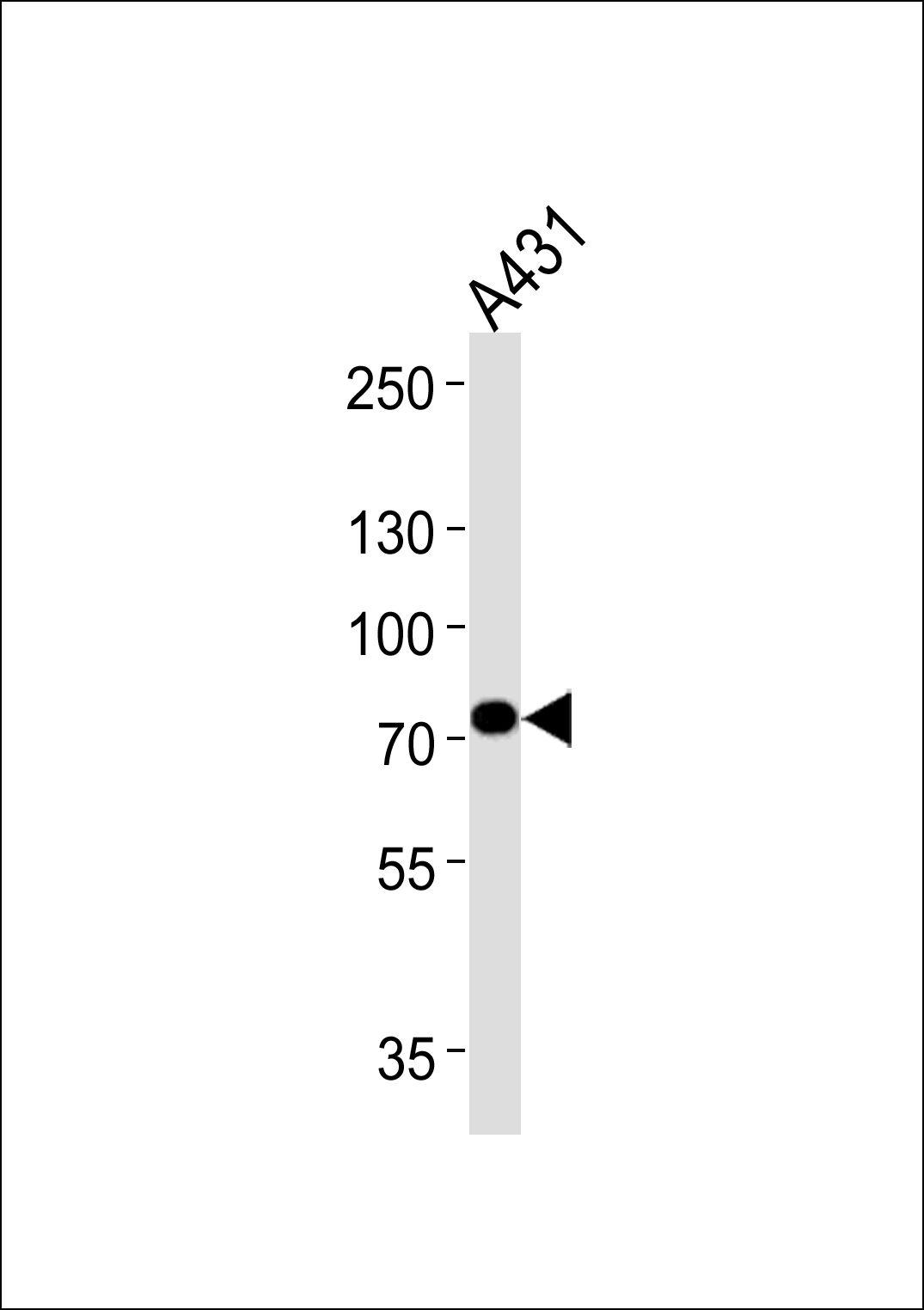 WB - HADHA Antibody (C-term) [Knockout Validated] AW5706-U100