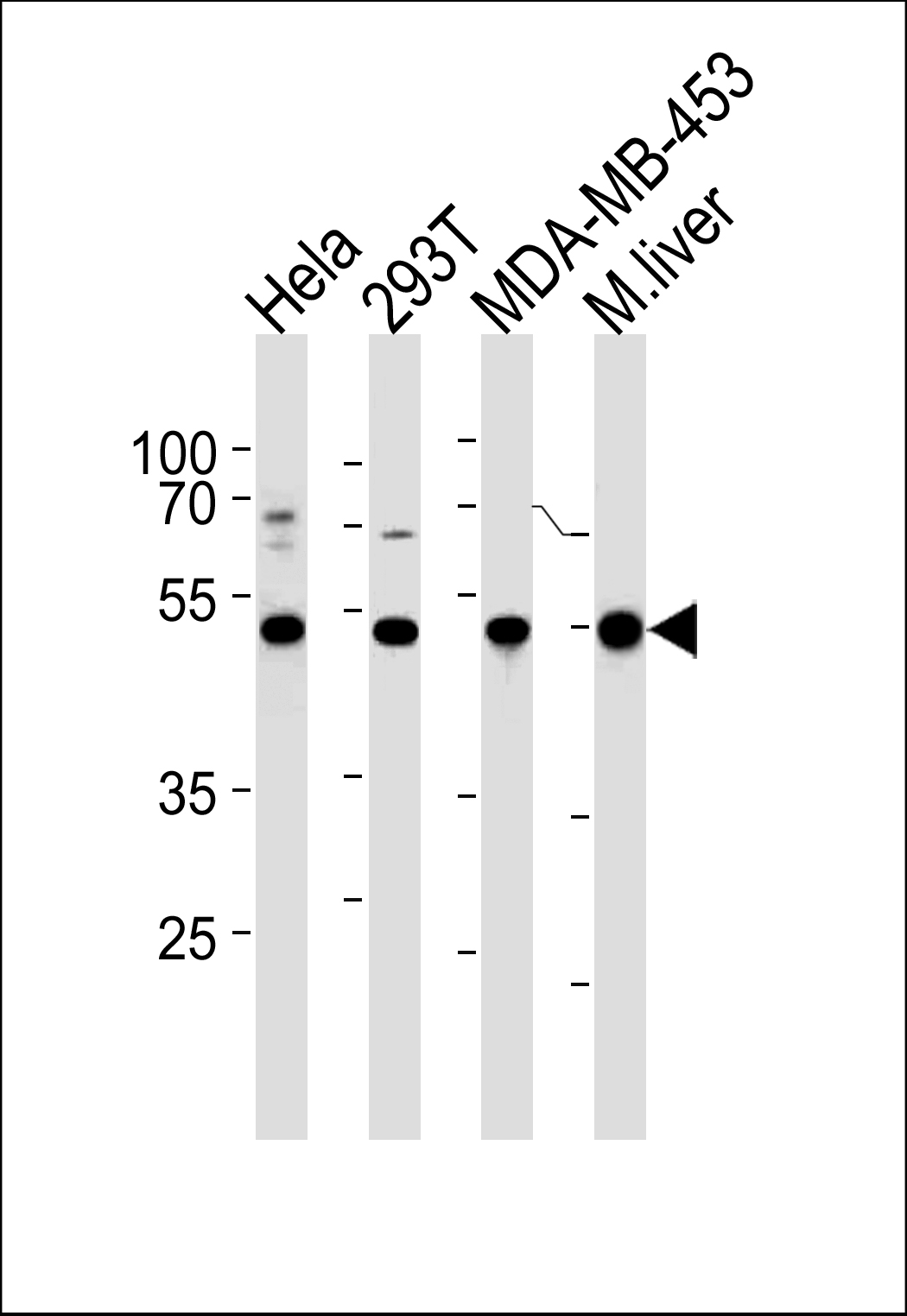 GSS Antibody (C-term) (Cat.# AP6895b) western blot analysis in Hela,293T,MDA-MB-453 cell line and mouse liver tissue lysates (35ug/lane).This demonstrates the GSS antibody detected the GSS protein (arrow).