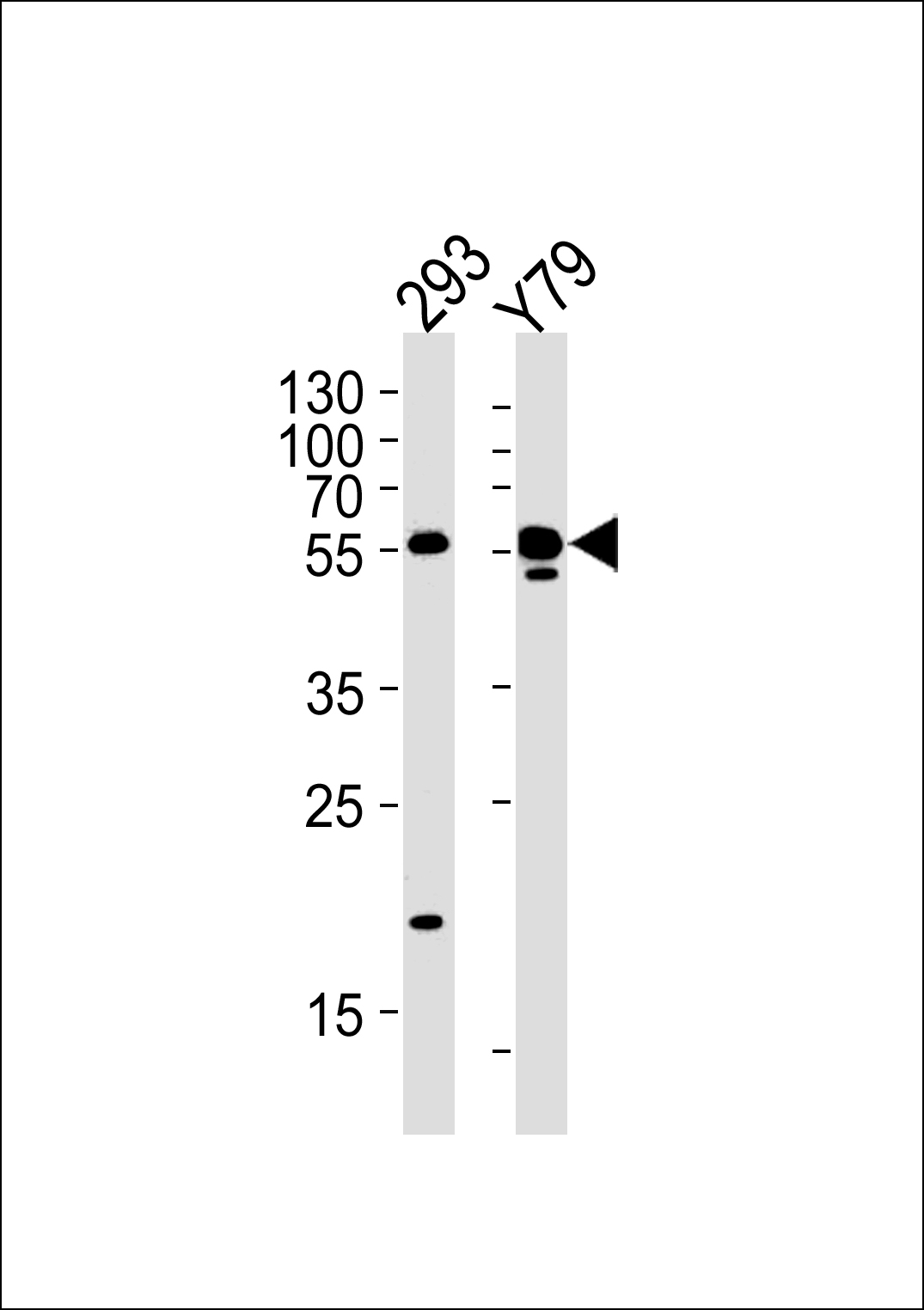 ALDH1A3 Antibody (N-term) (Cat.# AP7847a) western blot analysis in 293,Y79 cell line lysates (35ug/lane).This demonstrates the ALDH1A3 antibody detected the ALDH1A3 protein (arrow).