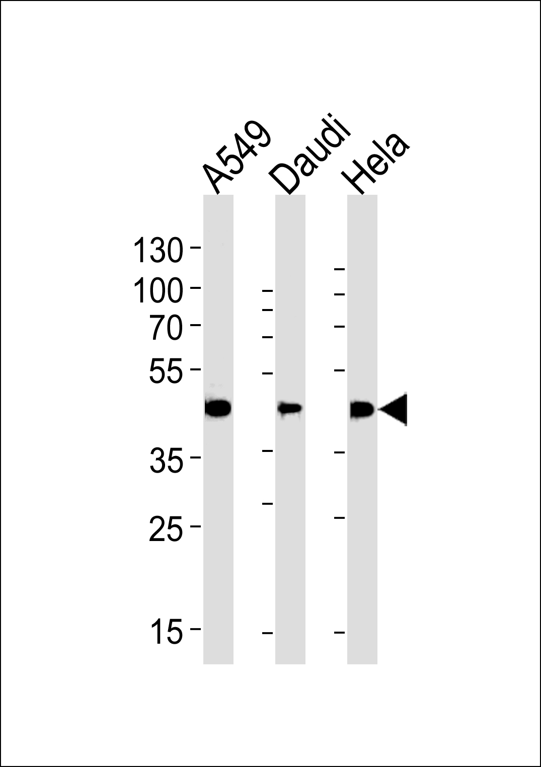 ALDH3A1 Antibody (Center) (Cat.# AP7849c) western blot analysis in A549,Daudi,Hela cell line lysates (35ug/lane).This demonstrates the ALDH3A1 antibody detected the ALDH3A1 protein (arrow).