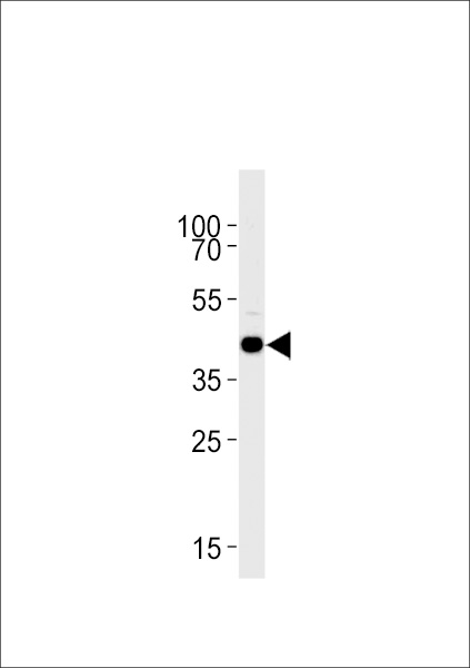 DANREs1pr1 Antibody (C-term) (Cat. #Azb10039a) western blot analysis in zebra fish brain tissue lysates (35ug/lane).This demonstrates the DANREs1pr1 antibody detected the DANREs1pr1 protein (arrow).