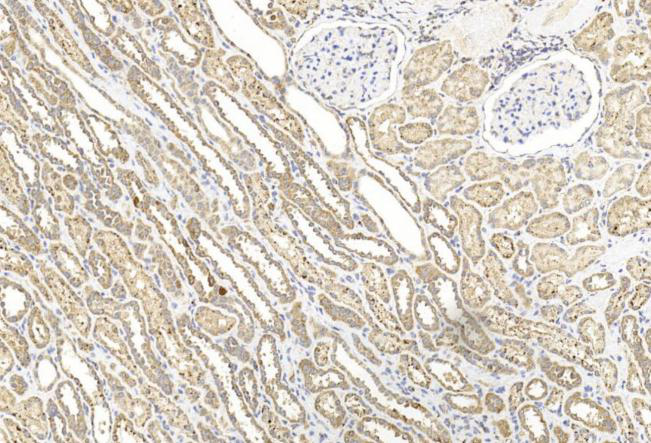 Immunohistochemical analysis of paraffin-embedded Human kidney section using Pink1(Cat#am2250b). am2250b was diluted at 1:250 dilution. A undiluted biotinylated goat polyvalent antibody was used as the secondary, followed by DAB staining.