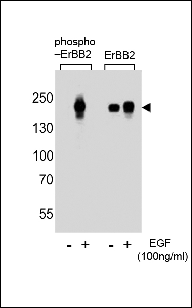 Western blot analysis of extracts from A431 cells, untreated or treated with EGF at 100ng/ml, using phospho-ErBB2 (Y1112) (left) or ErBB2 antibody (right).