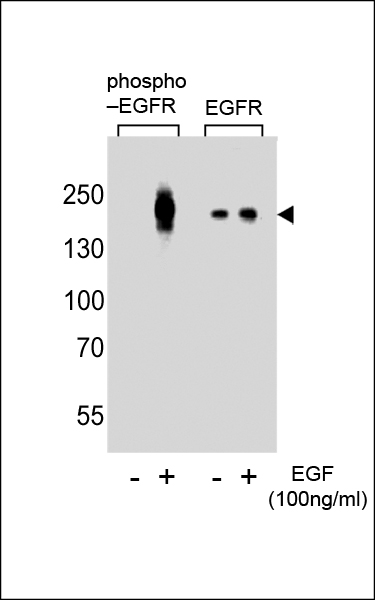 Western blot analysis of lysate from A431 cells(from left to right),untreated or treated with EGF at 100ng/ml,using Phospho-EGFR-pY1016 Antibody (Cat. #AP3507a) or EGFR-pS695 Antibody.Lysate at 15ug per lane.AP3507a was diluted at 1:8000 dilution at each lane. A goat anti-rabbit IgG H&L (HRP) at 1:5000 dilution was used as the secondary antibody.