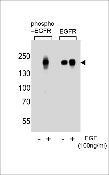 Western blot analysis of lysate from A431 cells(from left to right),untreated or treated with EGF at 100ng/ml,using Phospho-EGFR-pS768 Antibody (Cat. #AP3017a) or EGFR-pS695 Antibody.Lysate at 15ug per lane.AP3017a was diluted at 1:1000 dilution at each lane. A goat anti-rabbit IgG H&L (HRP) at 1:5000 dilution was used as the secondary antibody.