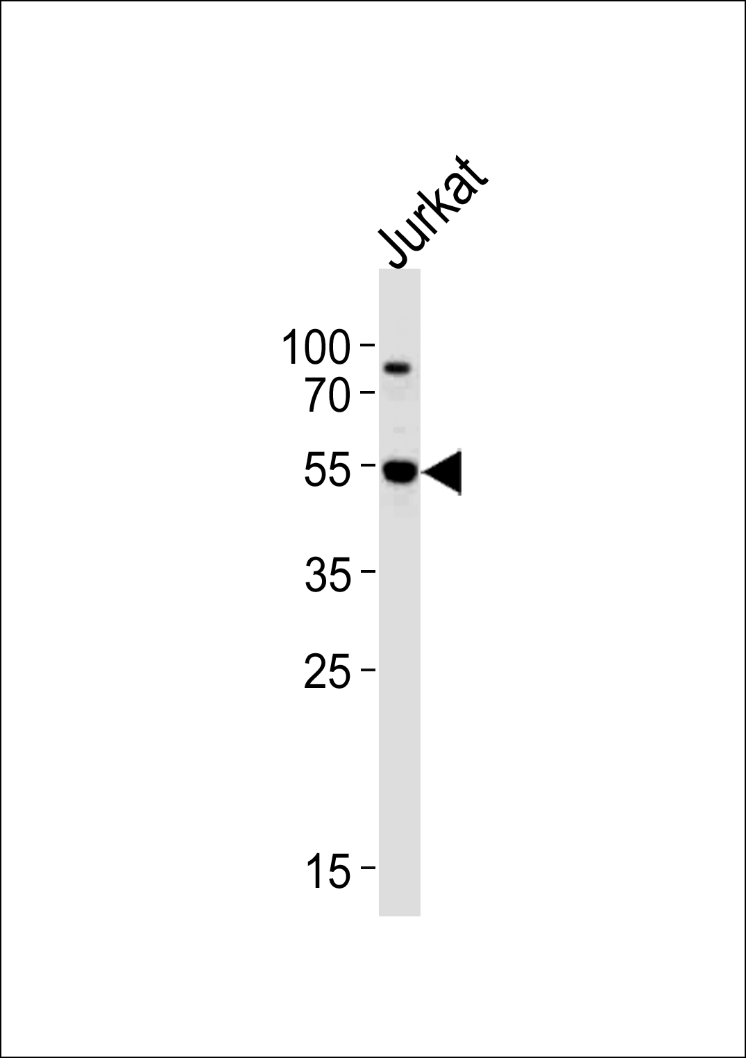 Western blot analysis of lysate from Jurkat cell line,using AKT3 Antibody (Q103)(Cat. #AP7030c).AP7030c was diluted at 1:1000 at each lane. A goat anti-rabbit IgG H&L(HRP) at 1:5000 dilution was used as the secondary antibody.Lysate at 35ug per lane.