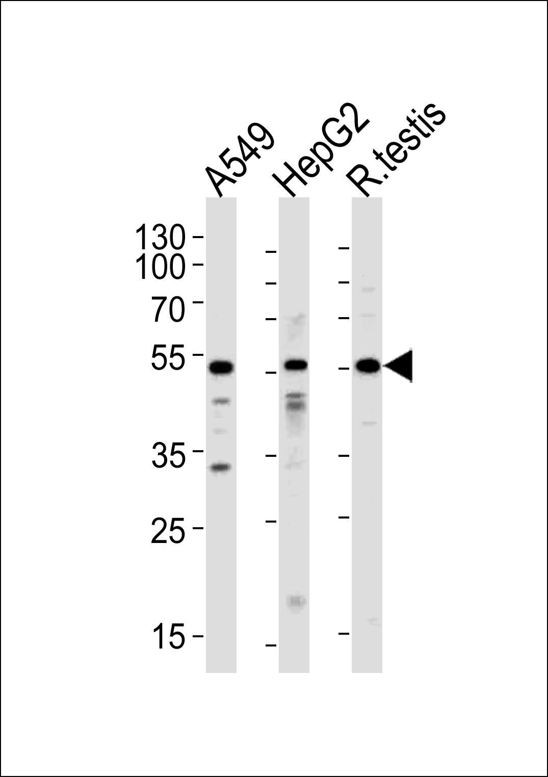 WB - Activin Receptor Type IA (ACVR1) Antibody (N-term) AP7101b