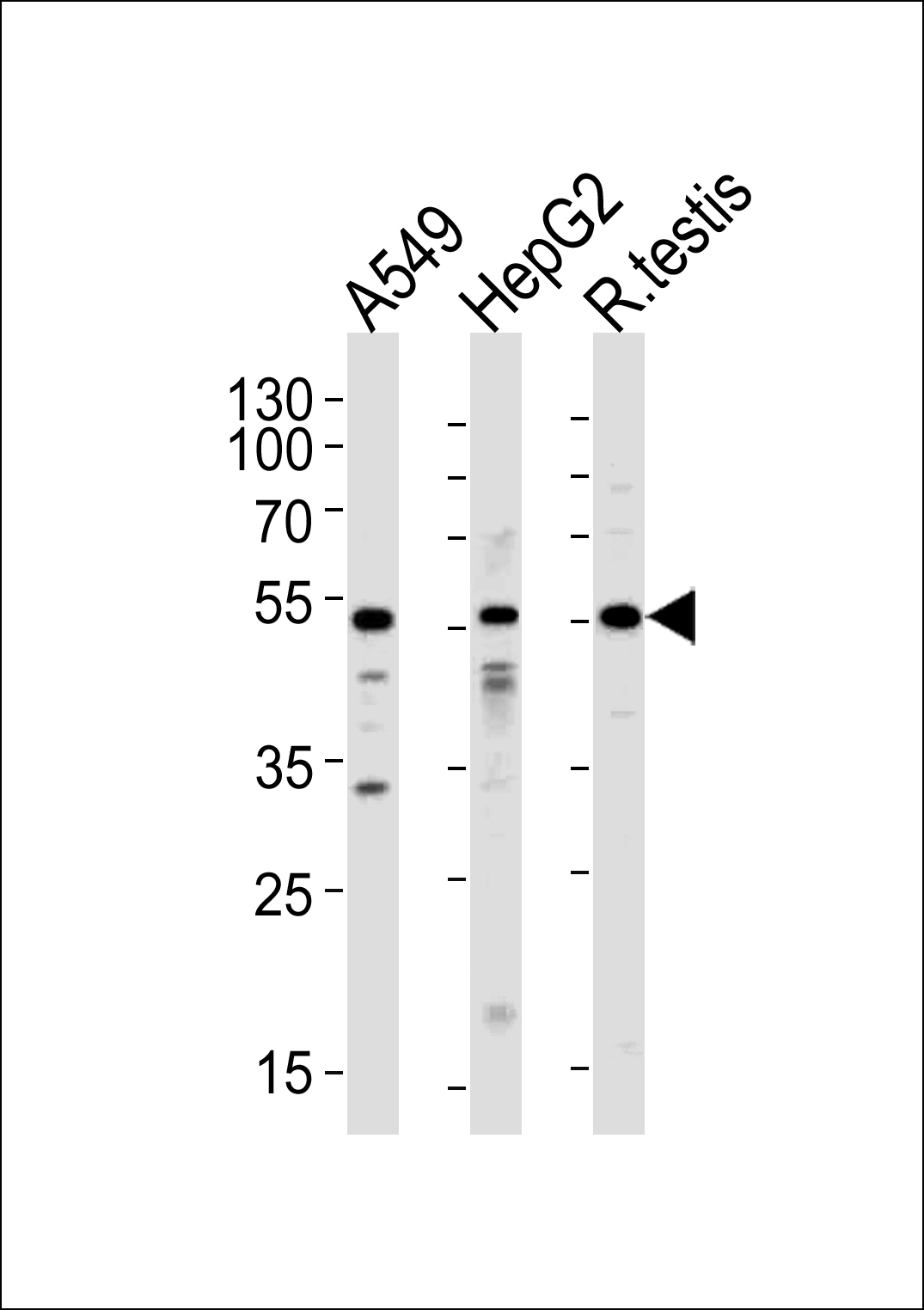 Western blot analysis of lysates from A549,HepG2 cell line and rat testis tissue (from left to right),using ACVR1 Antibody (N-term)(Cat. #AP7101b).AP7101b was diluted at 1:1000 at each lane. A goat anti-rabbit IgG H&L(HRP) at 1:5000 dilution was used as the secondary antibody.Lysates at 35ug per lane.