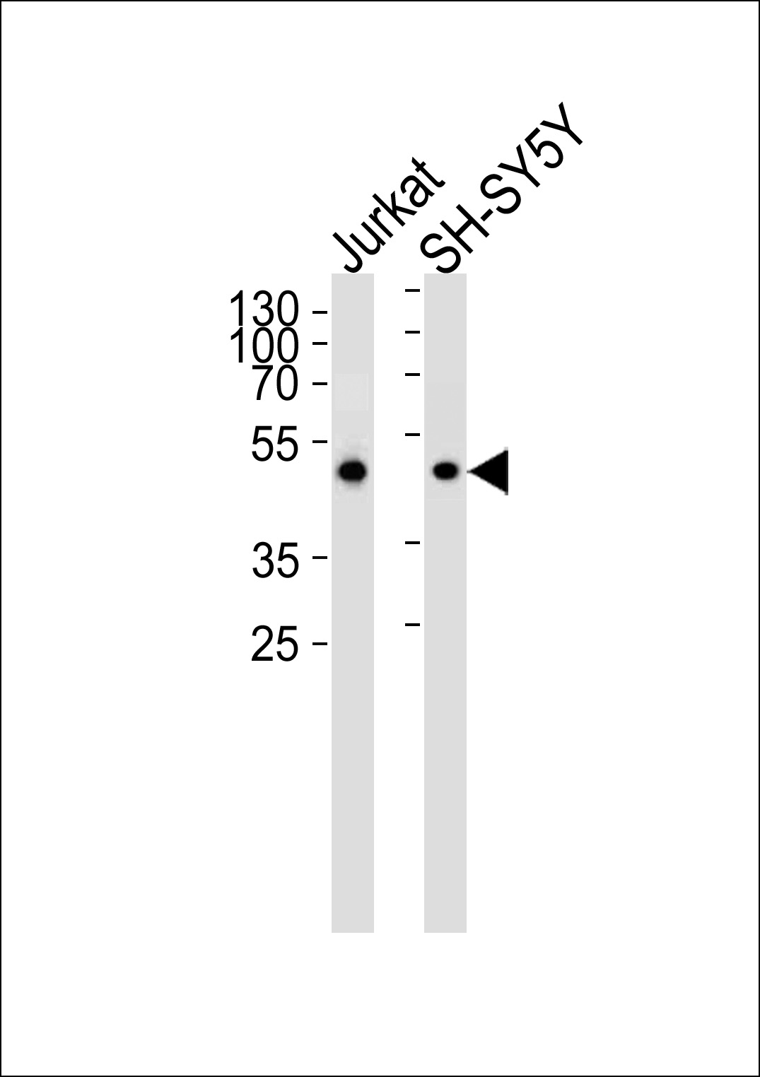 ANXA7 Antibody (Center) (Cat.# AP8738c) western blot analysis in Jurkat and SH-SY5Y cell lysates (35ug/lane). This demonstrates that the ANXA7 antibody detected ANXA7 protein (arrow).