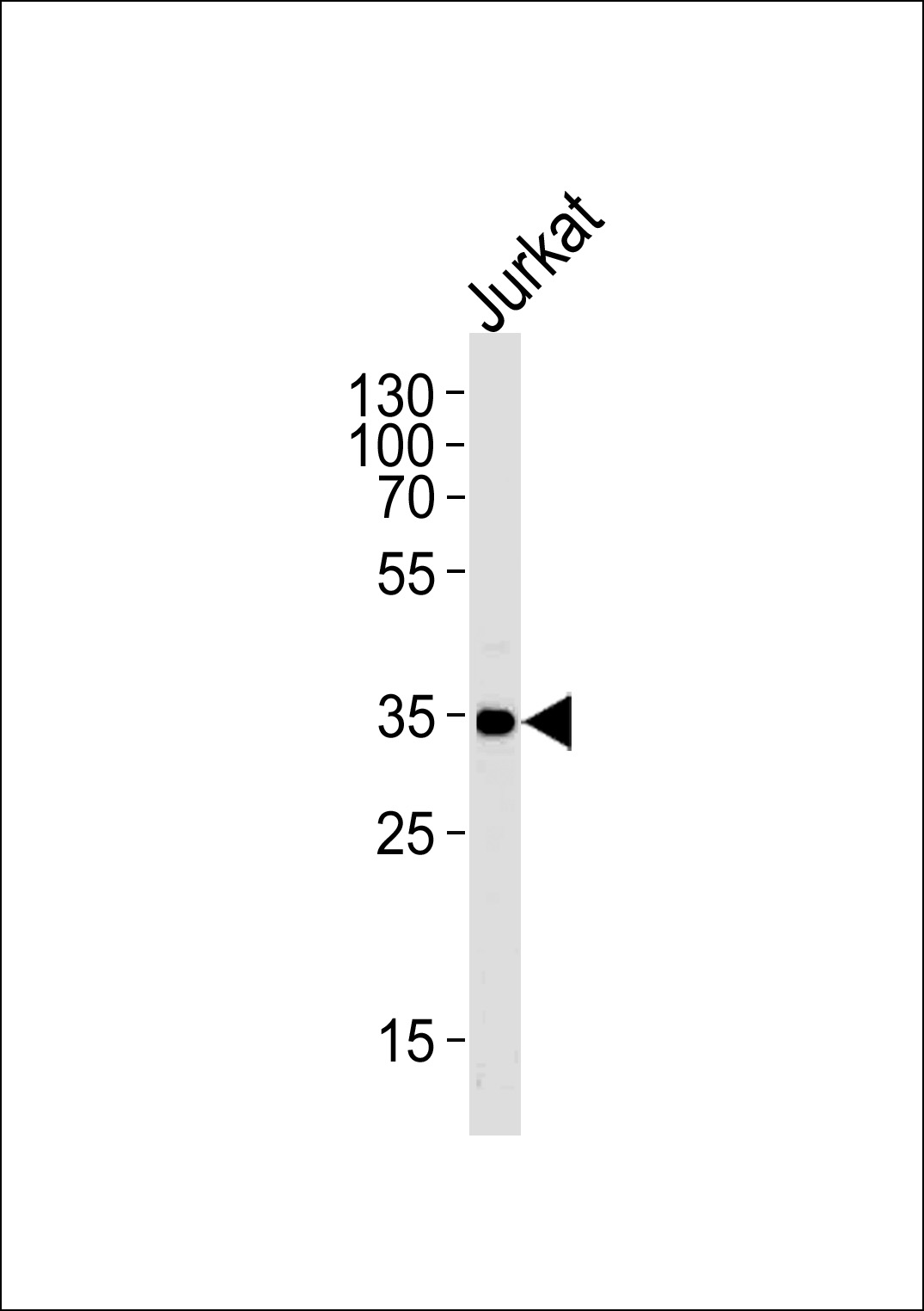 Western blot analysis of lysate from Jurkat cell line,using FCGR2A Antibody (C-term)(Cat. #AP8918b).AP8918b was diluted at 1:1000 at each lane. A goat anti-rabbit IgG H&L(HRP) at 1:5000 dilution was used as the secondary antibody.Lysate at 35ug per lane.