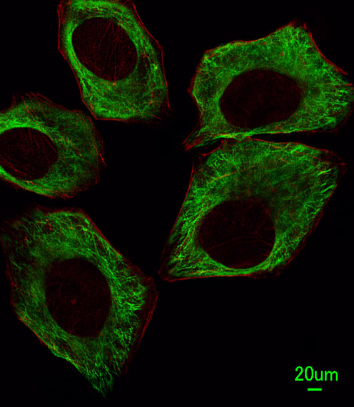 Immunofluorescent analysis of A549 cells, using TBB5 Antibody (Cat. #AM1031a). AM1031a  was diluted at 1?25 dilution. Dylight Fluor 488-conjugated goat anti-mouse lgG at 1:400 dilution was used as the secondary antibody (green). Cytoplasmic actin was counterstained with Dylight Fluor� 554 (red) conjugated Phalloidin (red).