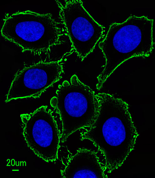 Immunofluorescent analysis of U251 cells, using KIT Antibody (Cat. #AM2137b). AM2137b was diluted at 1:100 dilution. Dylight Fluor 488-conjugated goat anti-mouse lgG at 1:400 dilution was used as the secondary antibody (green). Cytoplasmic actin was counterstained with Dylight Fluor� 554 (red) conjugated Phalloidin (red).