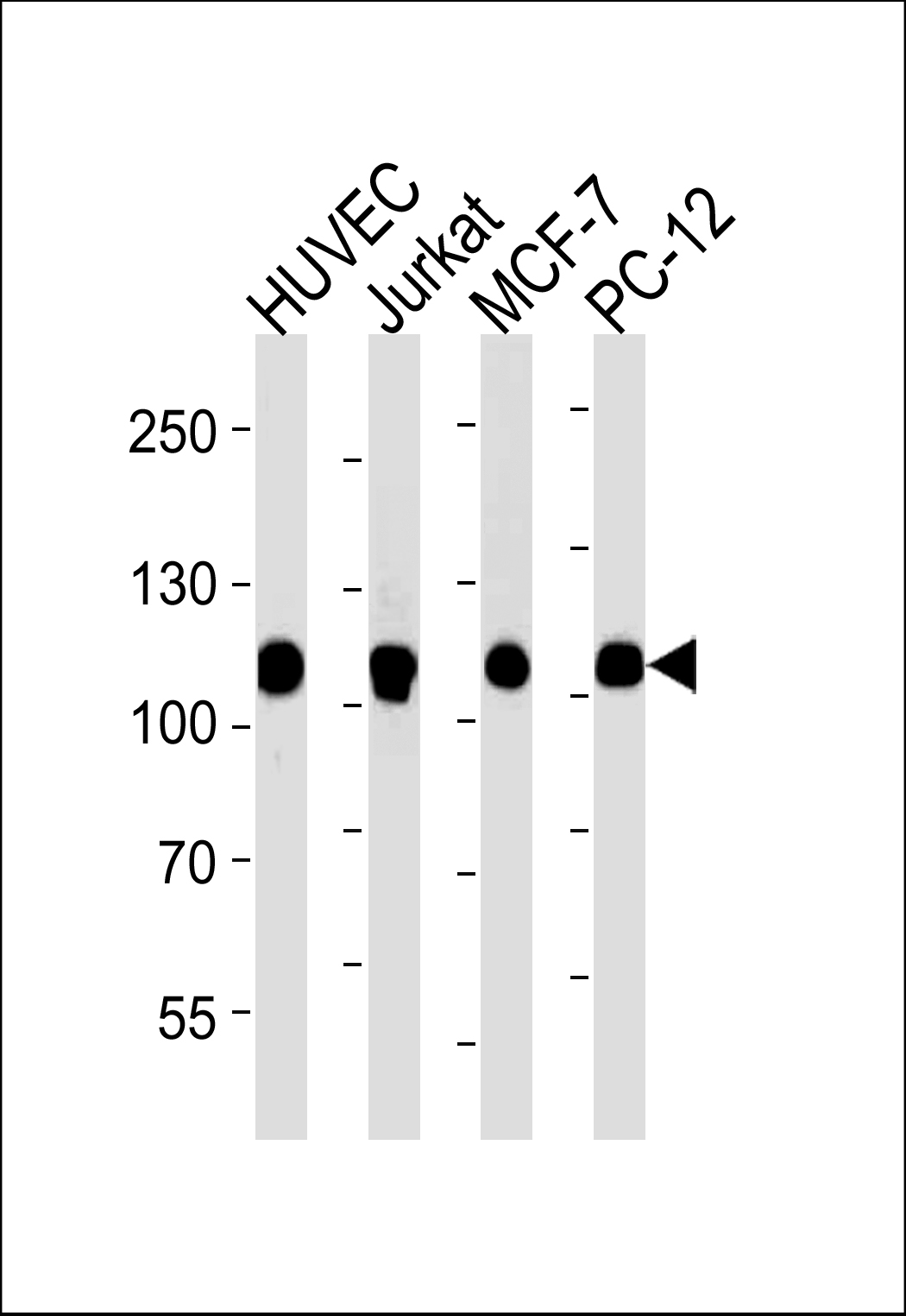 Western blot analysis of lysates from HUVEC, Jurkat, MCF-7, PC-12 cell line (from left to right), using TOP1 Antibody (N-term) (Cat. #AM2253a). AM2253a was diluted at 1:1000 at each lane. A goat anti-mouse IgG H&L(HRP) at 1:5000 dilution was used as the secondary antibody. Lysates at 35?g per lane.