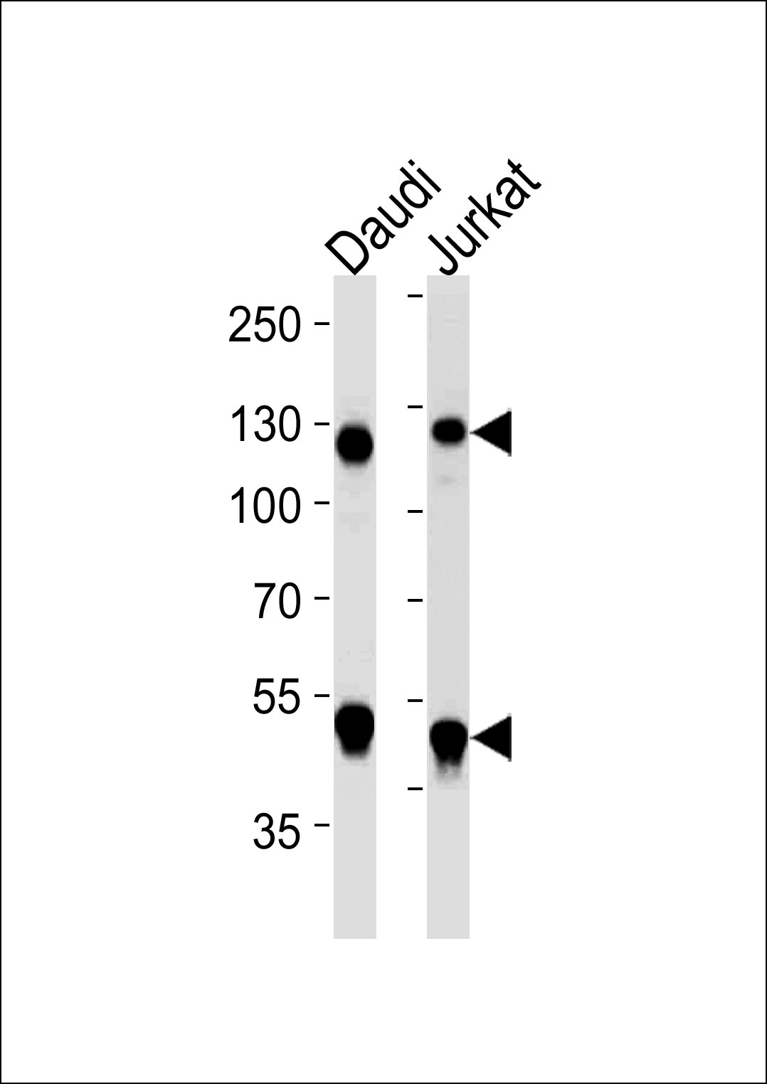 Western blot analysis of lysates from Daudi, Jurkat cell line (from left to right), using NFKB1 Antibody(Cat. #AM2254a). AM2254a was diluted at 1:1000 at each lane. A goat anti-mouse IgG H&L(HRP) at 1:5000 dilution was used as the secondary antibody. Lysates at 35?g per lane.