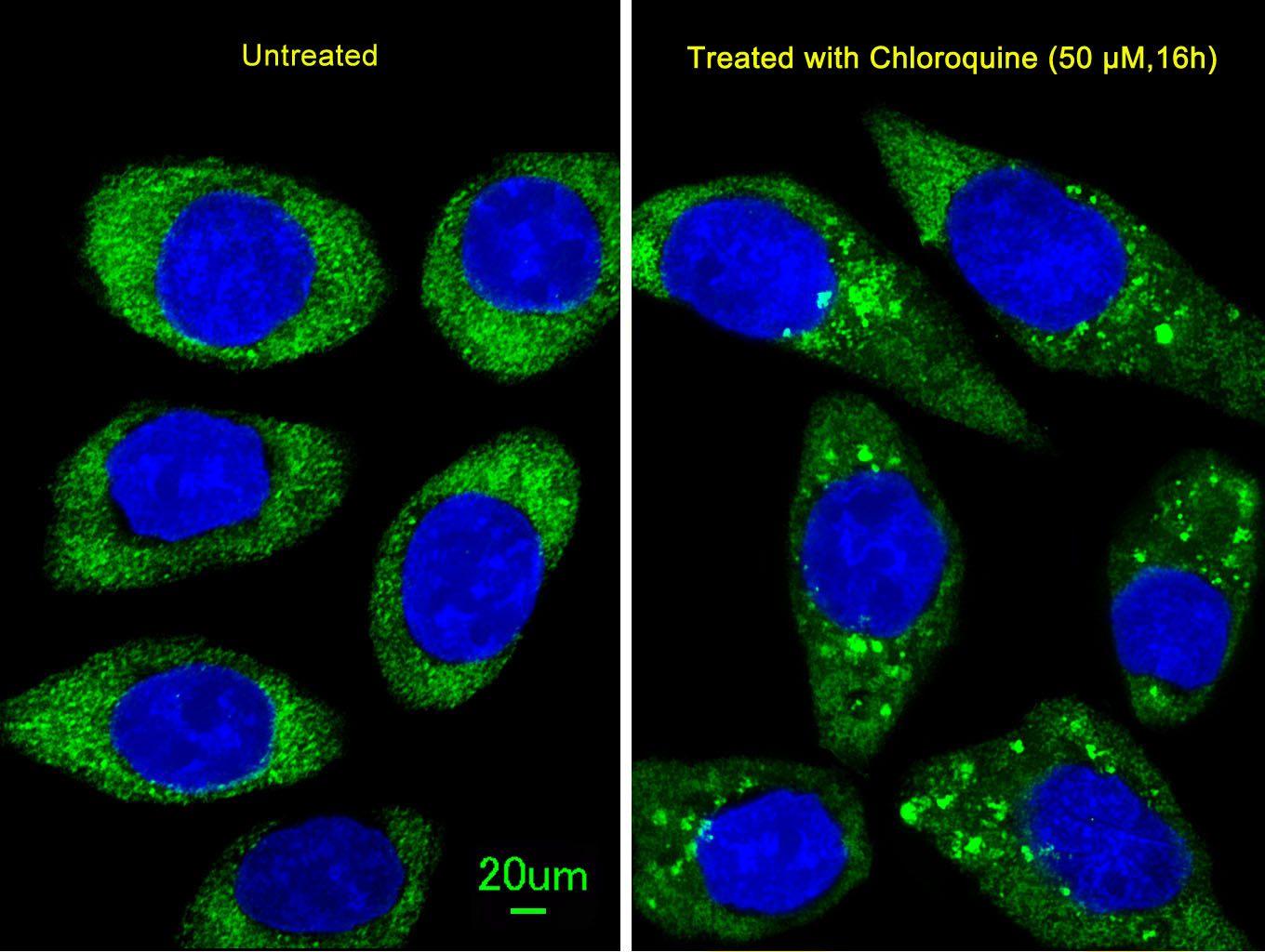 Immunofluorescent analysis of U251 cells, using ATG16L Antibody(Cat. #AP1817b). U251 cells(right) were treated with Chloroquine (50 ?M,16h). AP1817b was diluted at 1:25 dilution. Alexa Fluor 488-conjugated goat anti-rabbit lgG at 1:400 dilution was used as the secondary antibody (green).DAPI was used to stain the cell nuclear (blue).