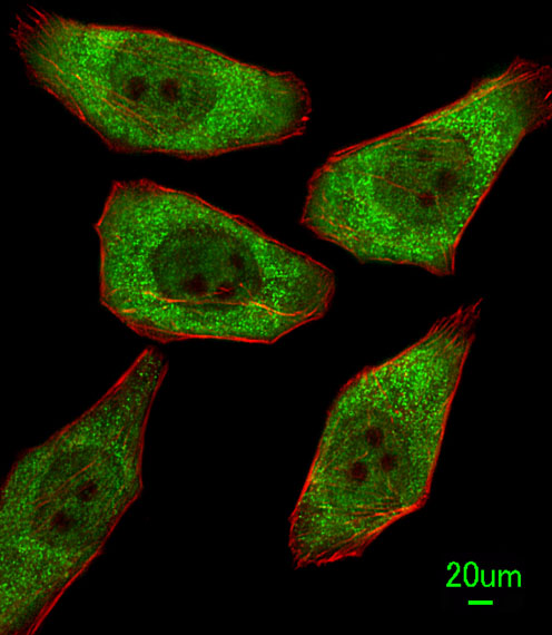 Immunofluorescent analysis of A549 cells, using FDPS Antibody (N-term) (Cat. #AP2418a). AP2418a was diluted at 1:100 dilution. Alexa Fluor 488-conjugated goat anti-rabbit lgG at 1:400 dilution was used as the secondary antibody (green). Cytoplasmic actin was counterstained with Dylight Fluor� 554 (red) conjugated Phalloidin (red).