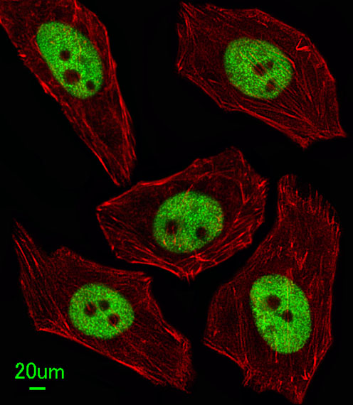 Immunofluorescent analysis of U251 cells, using FEN1 Antibody (Center) (Cat. #AP2856c). AP2856c was diluted at 1:100 dilution. Alexa Fluor 488-conjugated goat anti-rabbit lgG at 1:400 dilution was used as the secondary antibody (green). DAPI was used to stain the cell nuclear (blue).