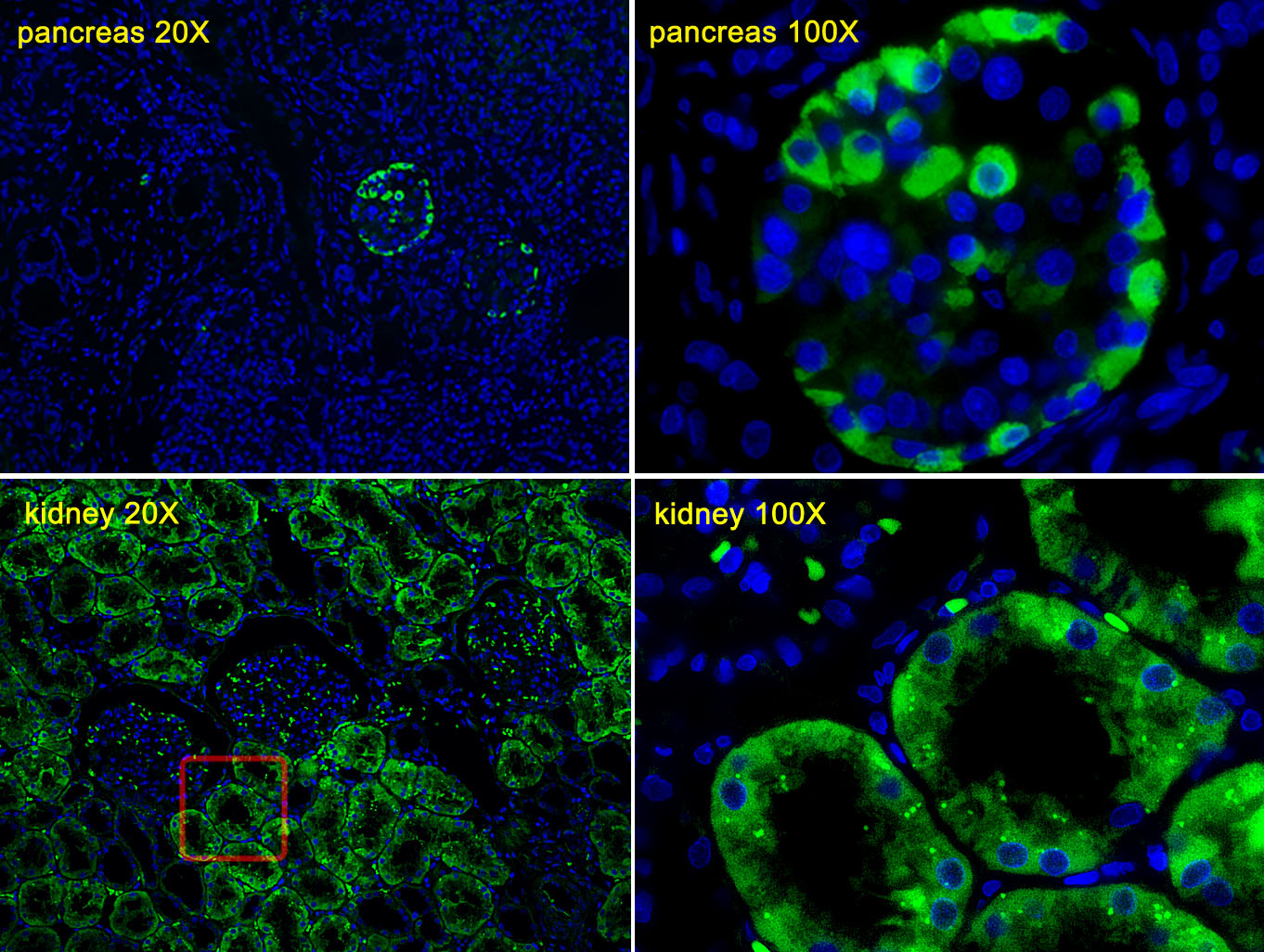 Immunofluorescent analysis of Human pancreas tissues and  Human kidney tissues, using TTR Antibody (C-term) (Cat. #AP6698b). AP6698b  was diluted at 1:25 dilution. Alexa Fluor 488-conjugated goat anti-rabbit lgG at 1:400 dilution was used as the secondary antibody (green). DAPI was used to stain the cell nuclear (blue).