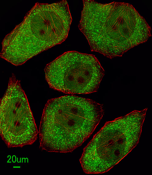 Immunofluorescent analysis of A549 cells, using ALOX12 Antibody (C-term) (Cat. #AP8877b). AP8877b was diluted at 1?100 dilution. Alexa Fluor 488-conjugated goat anti-rabbit lgG at 1:400 dilution was used as the secondary antibody (green). Cytoplasmic actin was counterstained with Dylight Fluor� 554 (red) conjugated Phalloidin (red).