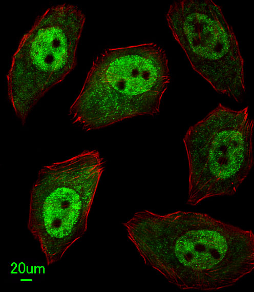 Immunofluorescent analysis of U251 cells, using APEX2 Antibody (Center) (Cat. #AP8975c). AP8975c was diluted at 1:25 dilution. Alexa Fluor 488-conjugated goat anti-rabbit lgG at 1:400 dilution was used as the secondary antibody (green). Cytoplasmic actin was counterstained with Dylight Fluor� 554 (red) conjugated Phalloidin (red).