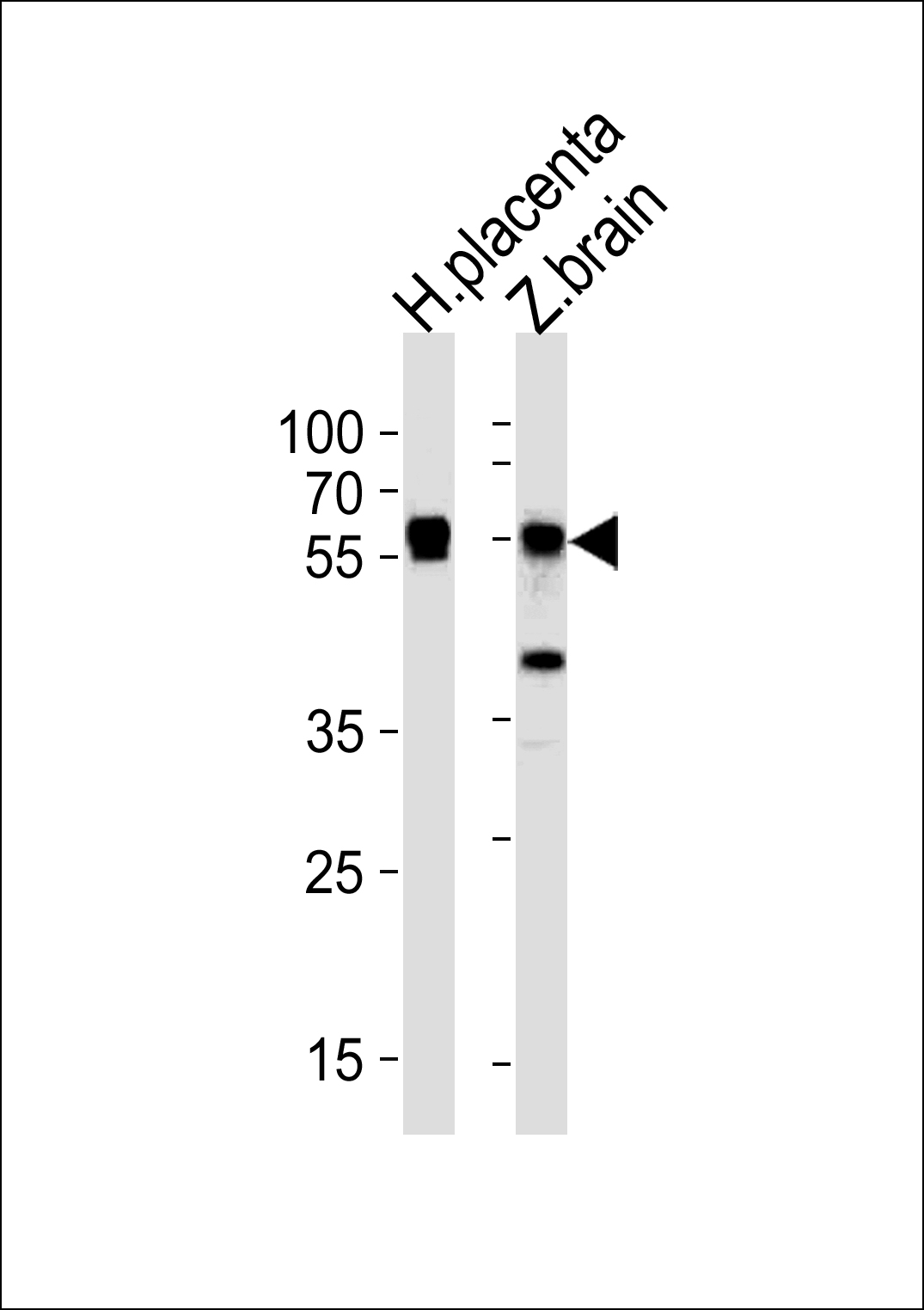 Western blot analysis of lysates from huaman placenta and zebra fish brain tissue (from left to right),using Zebrafishstk3(36kDa subunit) Antibody (Center)(Cat. #Azb10042a).Azb10042a was diluted at 1:1000 at each lane. A goat anti-rabbit IgG H&L(HRP) at 1:5000 dilution was used as the secondary antibody.Lysates at 35ug per lane.