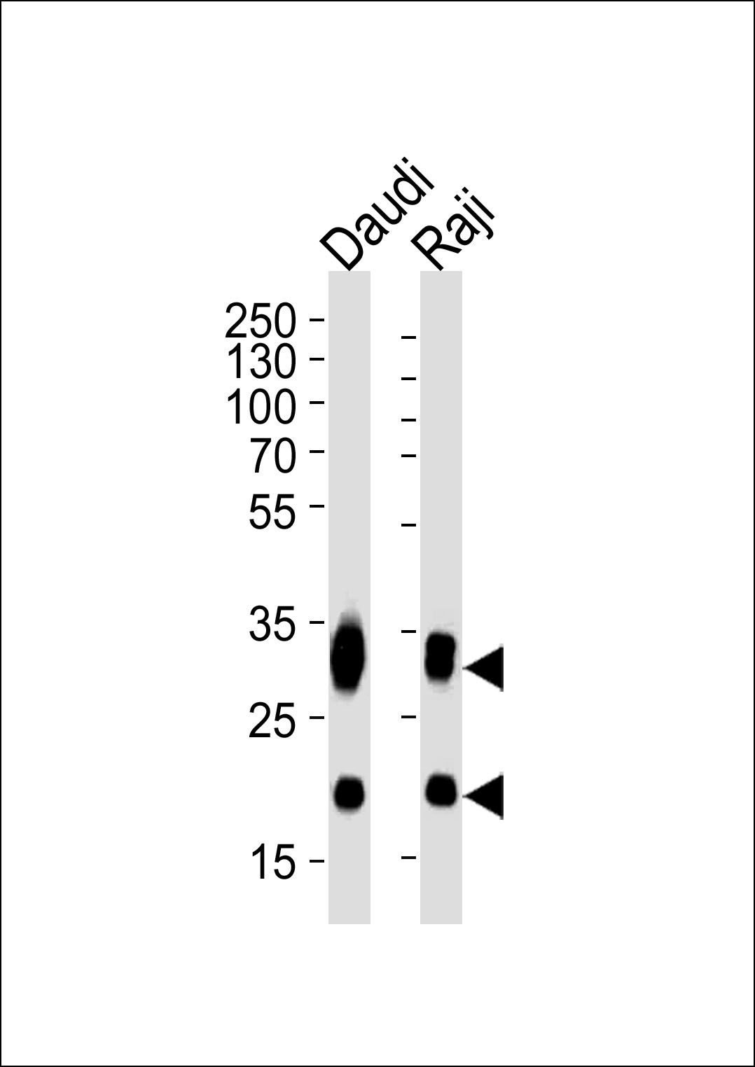 Western blot analysis of lysates from Daudi, Raji cell line (from left to right), using CD74 Antibody(Cat. # AM2257a). AM2257a was diluted at 1:1000 at each lane. A goat anti-mouse IgG H&L(HRP) at 1:5000 dilution was used as the secondary antibody. Lysates at 35?g per lane.