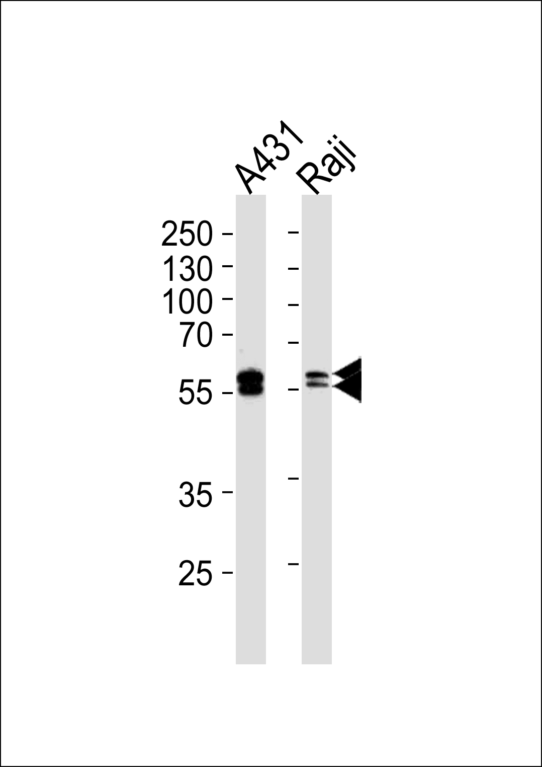 Western blot analysis of lysates from A431, Raji cell line (from left to right), using LYN Antibody(Cat. # AM2258a). AM2258a was diluted at 1:1000 at each lane. A goat anti-mouse IgG H&L(HRP) at 1:5000 dilution was used as the secondary antibody. Lysates at 35?g per lane.