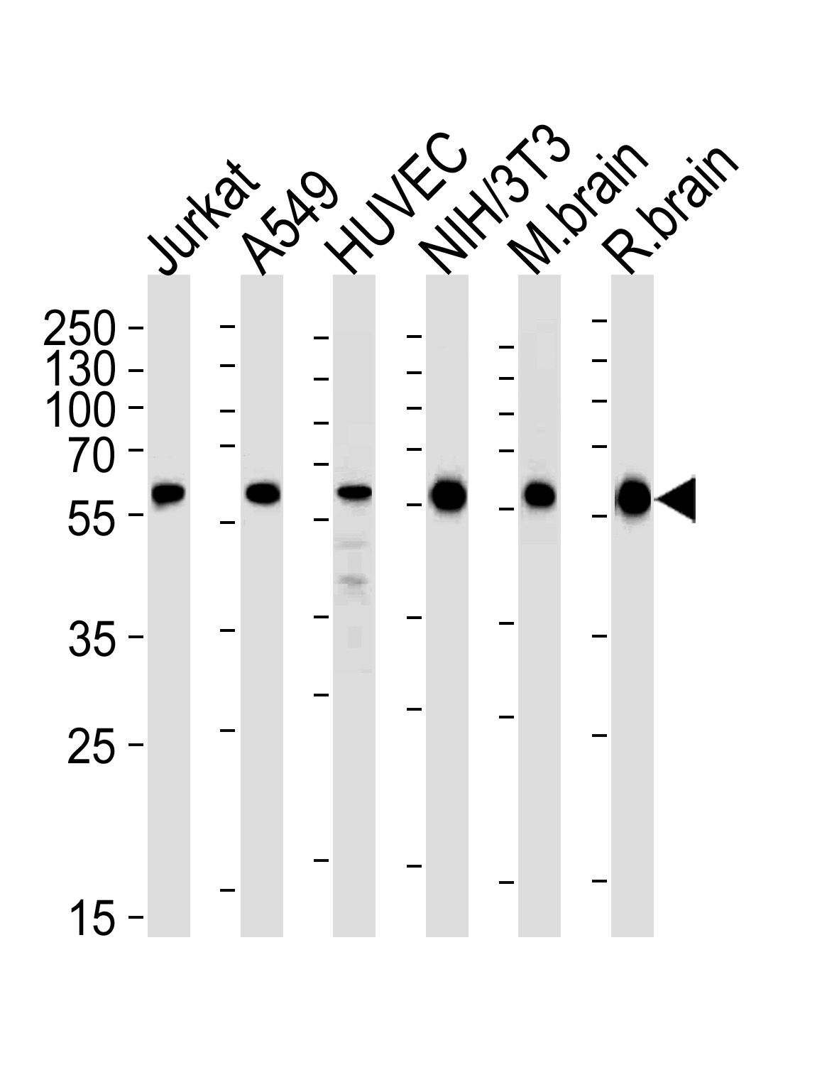 Western blot analysis of lysates from Jurkat,  A549,  HUVEC,  mouse NIH/3T3 cell line and mouse brain,  rat brain tissue lysates (from left to right),  using RAD23B Antibody (N-term) (Cat.  # AM2267b).  AM2267b was diluted at 1:1000 at each lane.  A goat anti-mouse IgG H&L(HRP) at 1:3000 dilution was used as the secondary antibody.  Lysates at 35?g per lane.