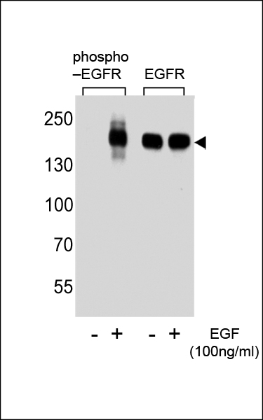Western blot analysis of extracts from A431 cell,  untreated or treated with EGF,  using phospho-EGFR-pS1070 (left) or ErBB2 antibody (right).
