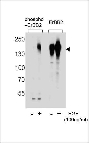 WB - Phospho-ERBB2(S1107) Antibody AP3781b
