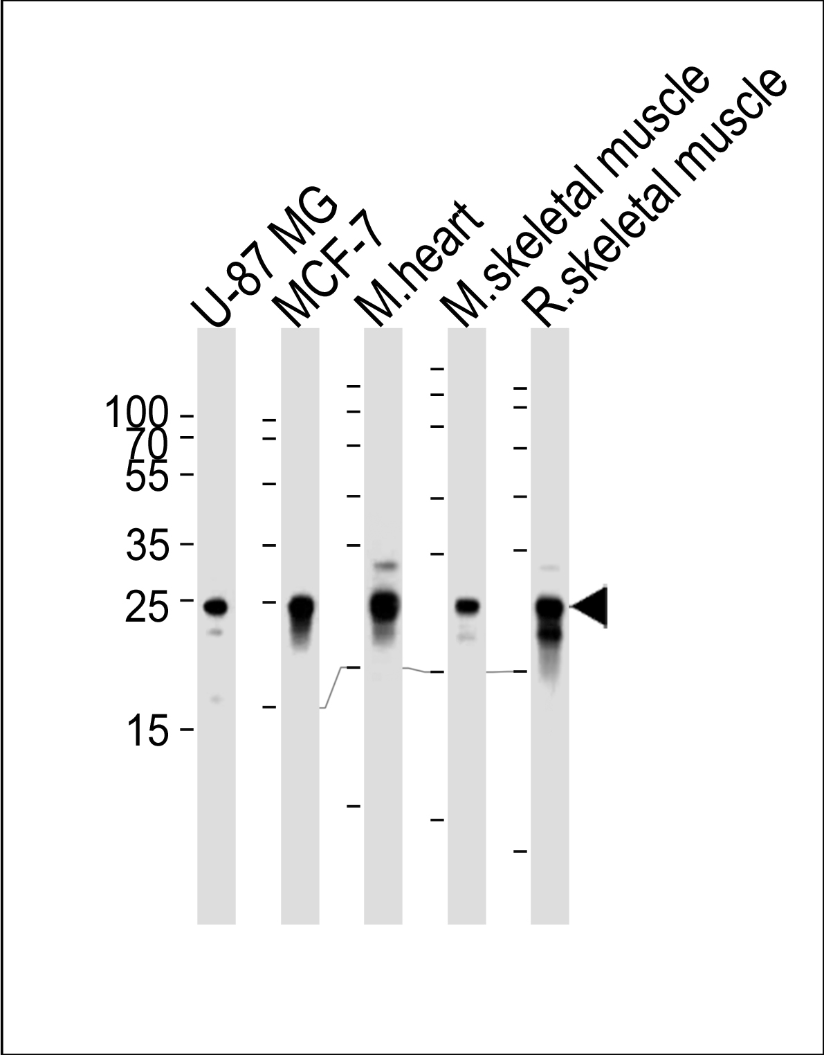 Western blot analysis of lysates from U-87 MG,  MCF-7 cell line,  mouse heart and skeletal muscle,  rat skeletal muscle tisue lysates (from left to right),  using CRYAB Antibody(Cat.  #AM8424b).  AM8424b was diluted at 1:1000 at each lane.   A goat anti-mouse IgG H&L(HRP) at 1:3000 dilution was used as the secondary antibody.  Lysates at 35?g per lane.