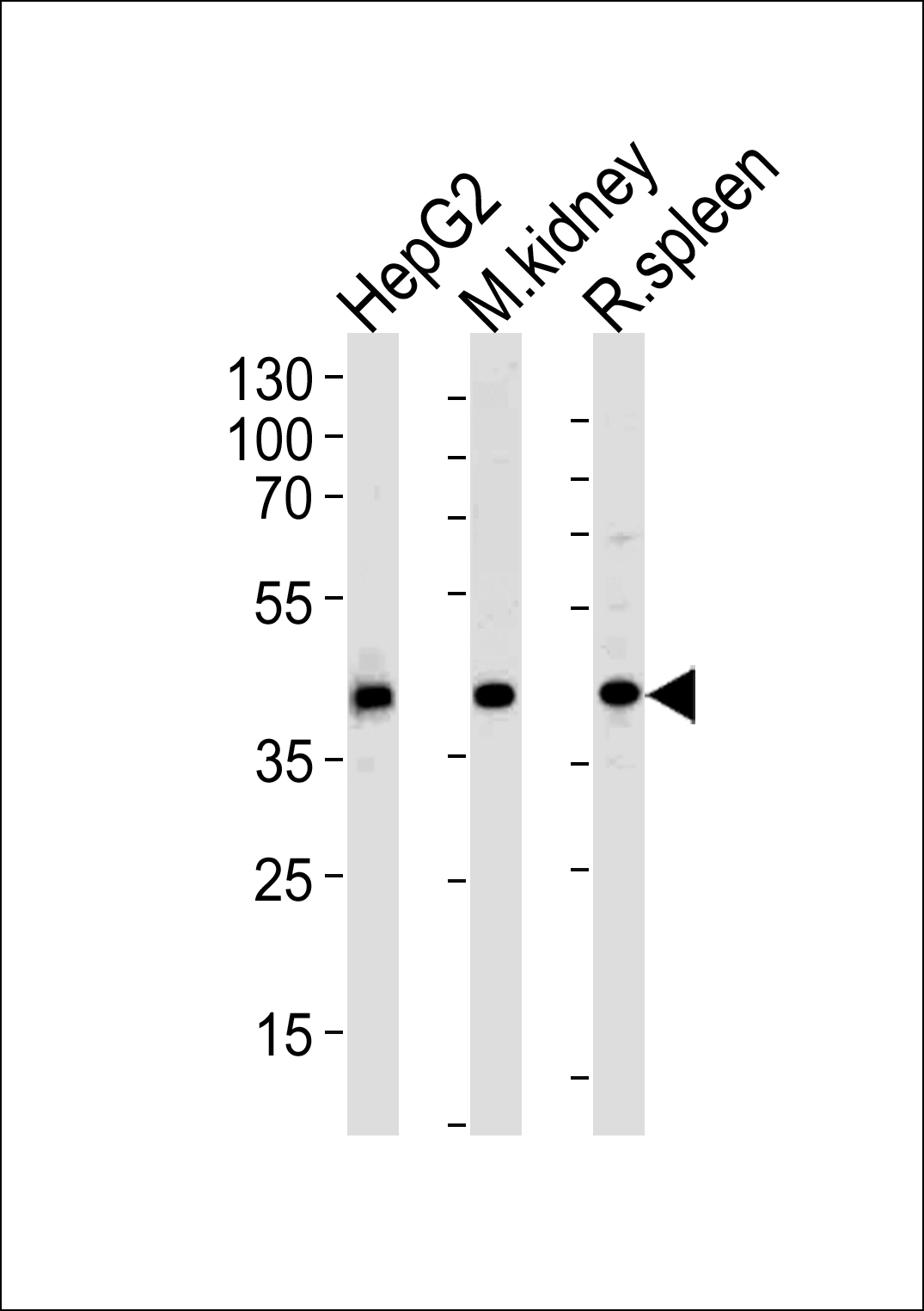 Western blot analysis of lysates from HepG2 cell line and mouse kidney,  rat spleen tissue lysates(from left to right),  using ACADL Antibody (N-term)(Cat.  #AP13134a).  AP13134a was diluted at 1:1000 at each lane.  A goat anti-rabbit IgG H&L(HRP) at 1:5000 dilution was used as the secondary antibody.  Lysates at 35ug per lane.
