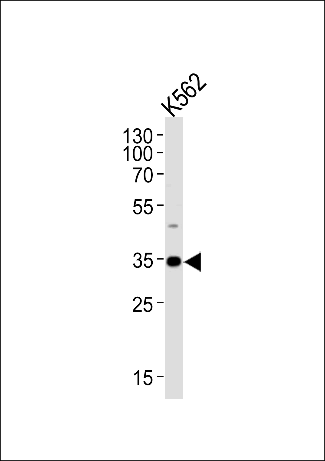 Western blot analysis of lysate from K562 cell line,  using BBS5 Antibody (Center)(Cat.  #AP20560a).  AP20560a was diluted at 1:1000.  A goat anti-rabbit IgG H&L(HRP) at 1:5000 dilution was used as the secondary antibody.  Lysate at 35ug.