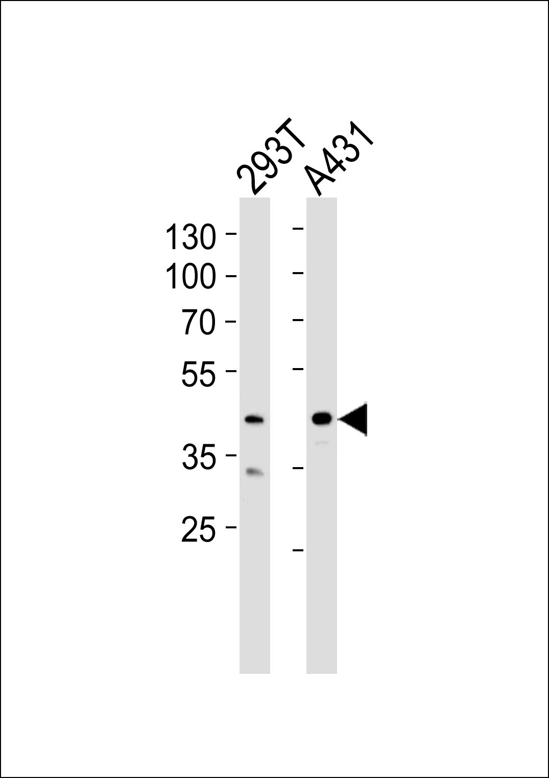 Western blot analysis of lysates from 293T, A431 cell line (from left to right), using CSNK2A1 Antibody (Center) (Cat.  #AP20578c).  AP20578c was diluted at 1:1000 at each lane.  A goat anti-rabbit IgG H&L(HRP) at 1:5000 dilution was used as the secondary antibody. Lysates at 35ug per lane.