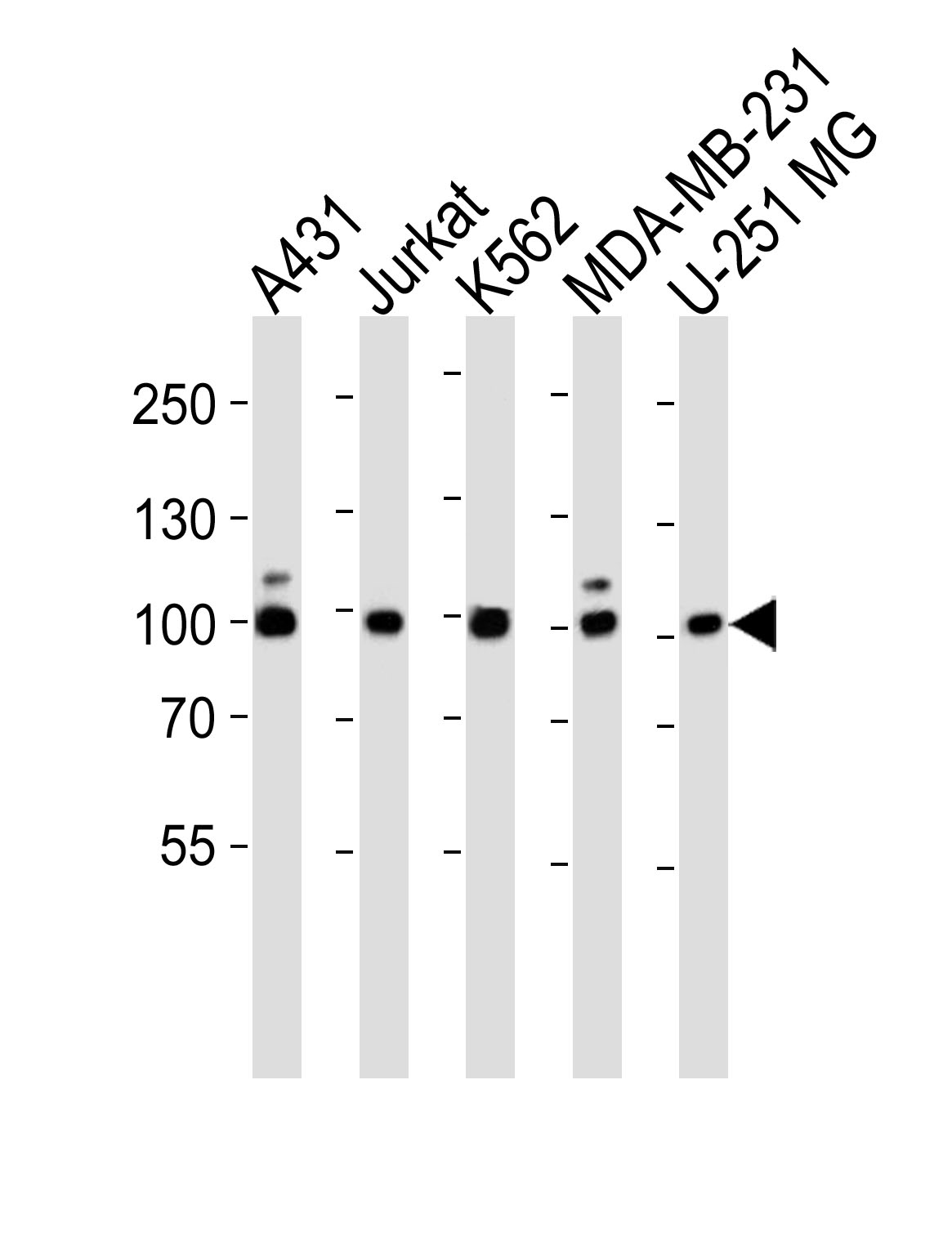 Western blot analysis of lysates from A431, Jurkat, K562, MDA-MB-231, U-251 MG cell line (from left to right), using ZNF175 Antibody (N-term) (Cat.  #AP20587a).  AP20587a was diluted at 1:1000 at each lane.  A goat anti-rabbit IgG H&L(HRP) at 1:5000 dilution was used as the secondary antibody. Lysates at 35ug per lane.