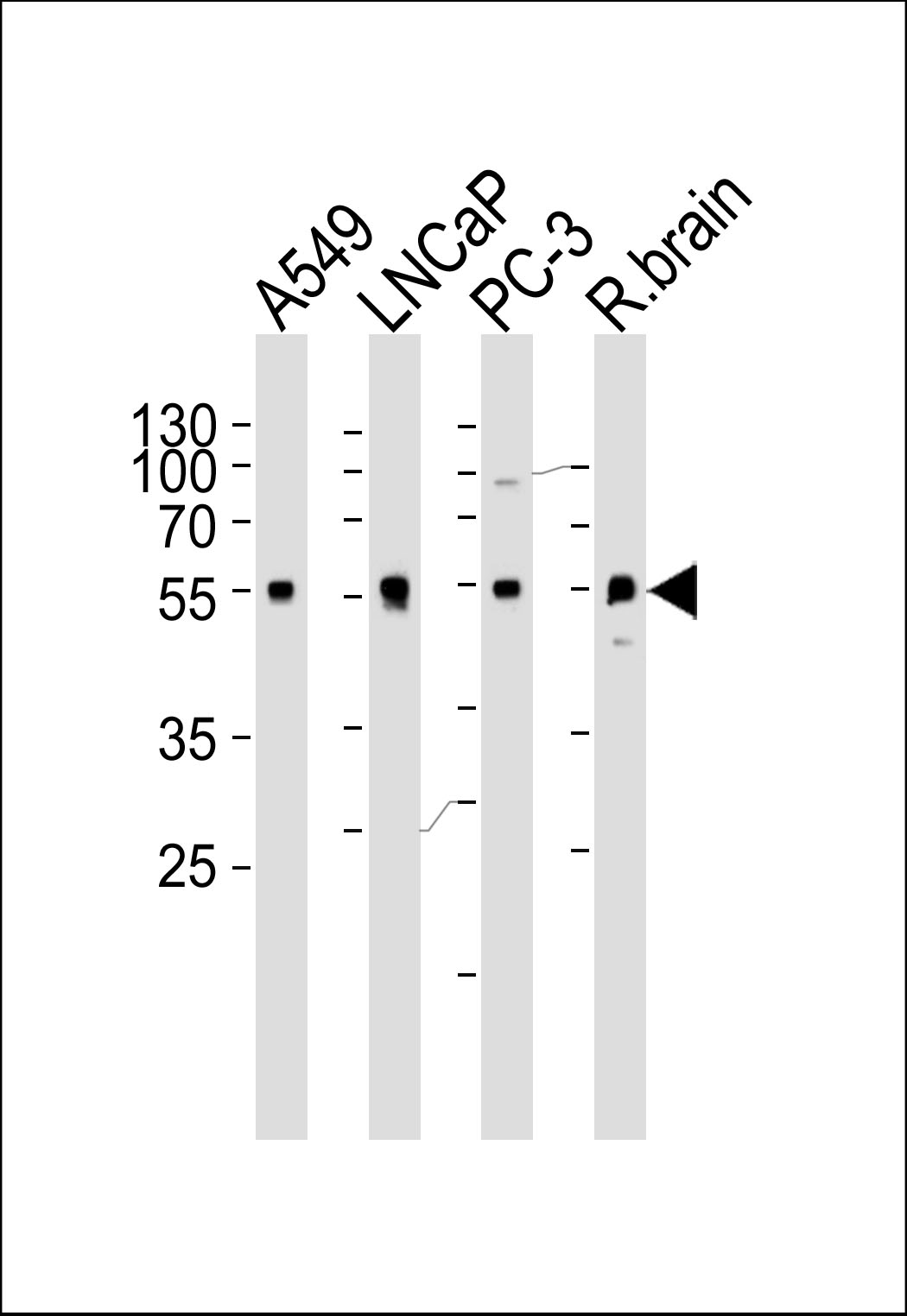 Western blot analysis of lysates from A549, LNCaP, PC-3 cell line and rat brain tissue lysate (from left to right), using ADRA1D Antibody (N-term) (Cat.  #AP20589a).  AP20589a was diluted at 1:1000 at each lane.  A goat anti-rabbit IgG H&L(HRP) at 1:5000 dilution was used as the secondary antibody. Lysates at 35ug per lane.