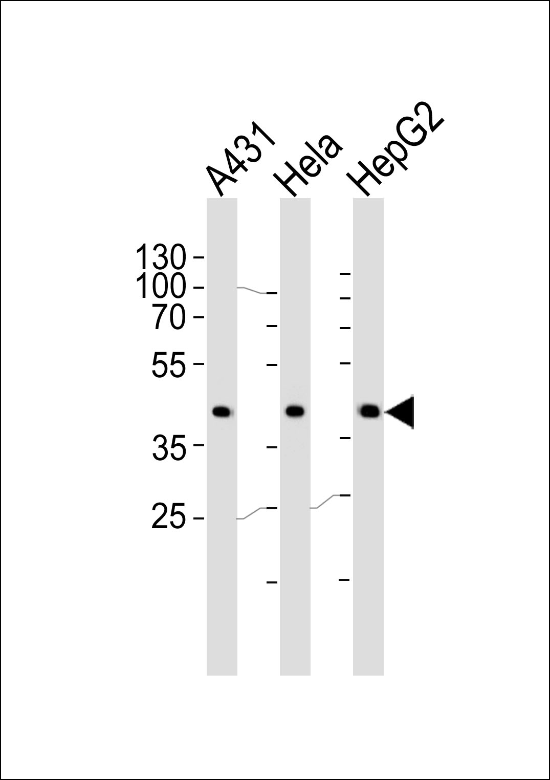 Western blot analysis of lysates from A431, Hela, HepG2 cell line (from left to right), using CSNK2A1 Antibody (Center) (Cat. # AP20595c).  AP20595c was diluted at 1:1000 at each lane.  A goat anti-rabbit IgG H&L(HRP) at 1:5000 dilution was used as the secondary antibody. Lysates at 35ug per lane.