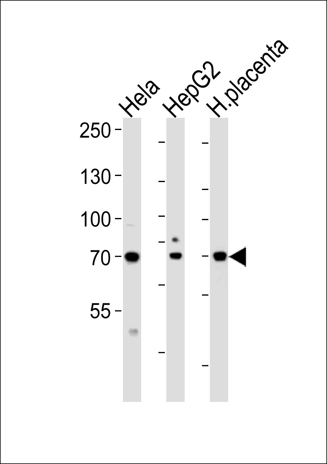 Western blot analysis of lysates from Hela, HepG2 cell line and human placenta tissue lysate (from left to right), using CREBL1Antibody (C-term) (Cat.  #AP5101b).  AP5101b was diluted at 1:1000 at each lane.  A goat anti-rabbit IgG H&L(HRP) at 1:5000 dilution was used as the secondary antibody.  Lysates at 35ug per lane.