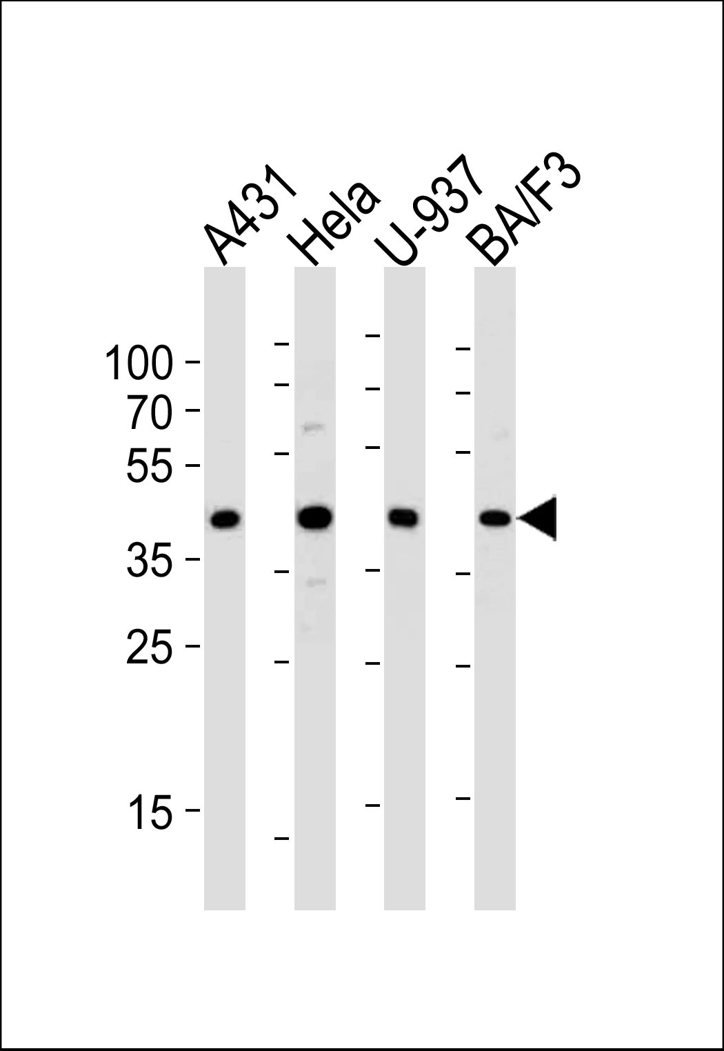 Western blot analysis of lysates from A431,  Hela,  U-937,  BA/F3 cell line (from left to right),  using PGK1 Antibody (S320) (Cat.  #AP7169a).  AP7169a was diluted at 1:1000 at each lane.  A goat anti-rabbit IgG H&L(HRP) at 1:5000 dilution was used as the secondary antibody.  Lysate at 35ug per lane.
